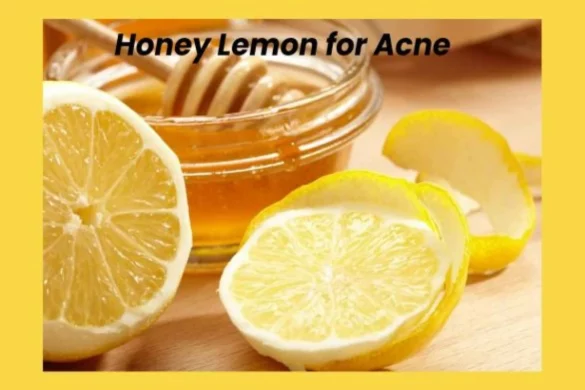 How is Honey Lemon for Acne Useful?