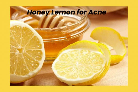 Honey Lemon for Acne