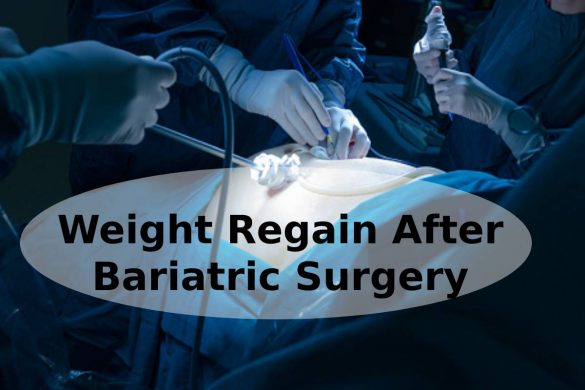 Weight Regain After Bariatric Surgery