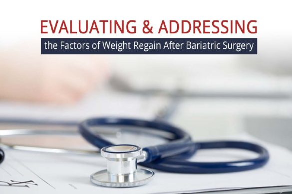 Why is Weight Regain After Bariatric Surgery